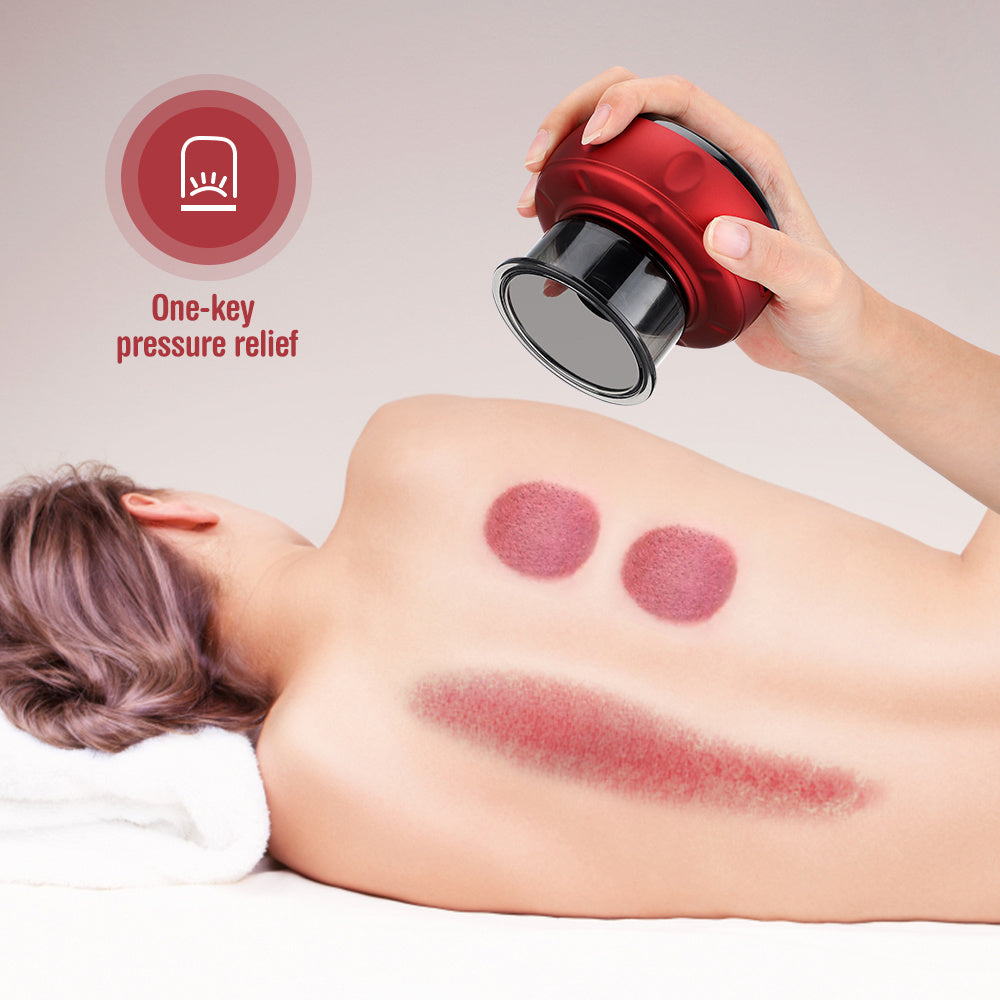 Electric Vacuum Cupping Massager – Anti-Cellulite & Slimming Therapy