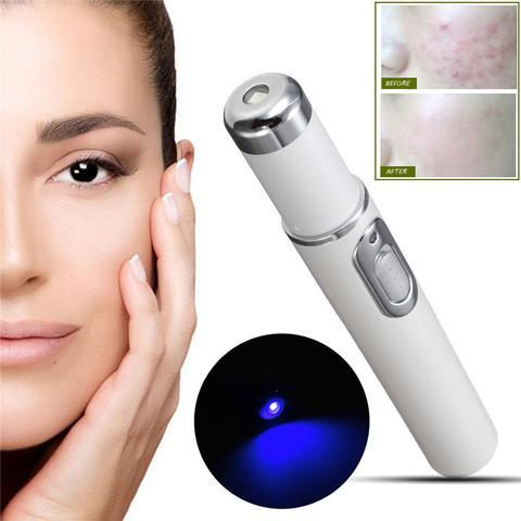 Blue Light Therapy Laser Pen – Acne, Scar & Wrinkle Removal Beauty Device